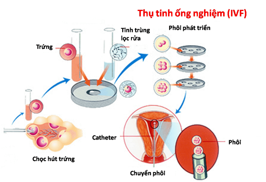 [:vi]Qui trình thụ tinh ống nghiệm và các kỹ thuật liên quan[:en]Considered spicy scallops[:]