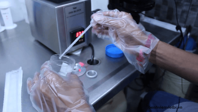 Xét nghiệm tinh dịch đồ đánh giá khả năng sinh sản cho nam giới
