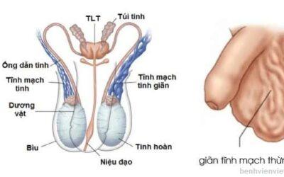 [:vi]Nguyên nhân vô sinh[:]