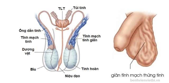 [:vi]Nguyên nhân vô sinh[:]