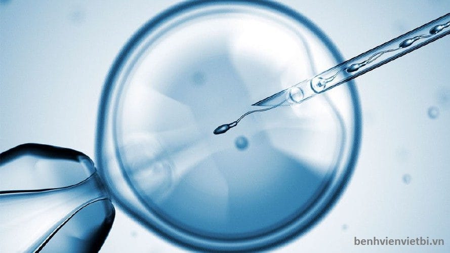 CÁC PHƯƠNG PHÁP ĐIỀU TRỊ VÔ SINH TIÊN TIẾN NHẤT HIỆN NAY