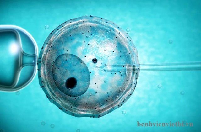 5 BƯỚC QUAN TRỌNG TRƯỚC KHI LÀM THỤ TINH TRONG ỐNG NGHIỆM (IVF)