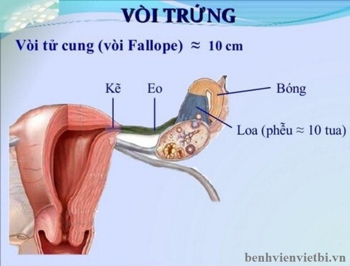 TẮC VÒI TRỨNG YẾU TỐ GÂY VÔ SINH NỮ GIỚI