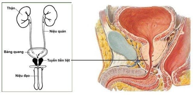 UNG THƯ TIỀN LIỆT TUYẾN VÀ PHƯƠNG PHÁP ĐIỀU TRỊ