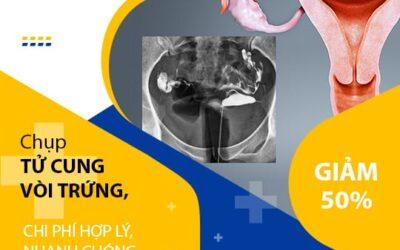 CHỤP TỬ CUNG VÒI TRỨNG – CHI PHÍ HỢP LÝ, NHANH CHÓNG VÀ  HIỆU QUẢ TẠI IVF VIỆT – BỈ