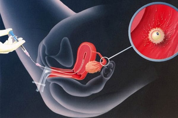 SỰ THAY ĐỔI CỦA CƠ THỂ TRƯỚC VÀ SAU KHI CHUYỂN PHÔI