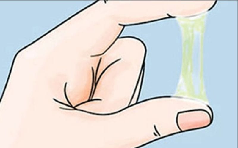 Sự bất thường ở tinh dịch