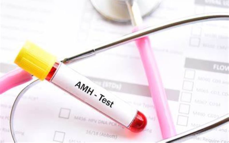 Kiểm tra dự trữ buồng trứng với xét nghiệm AMH tại BV Việt Bỉ