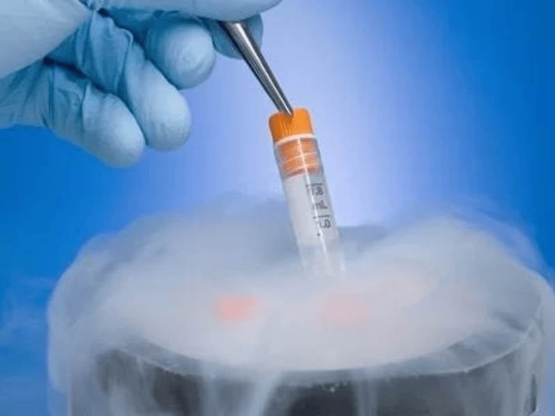 5 BƯỚC CHUẨN BỊ QUAN TRỌNG TRƯỚC KHI LÀM IVF