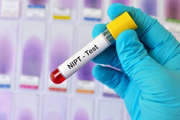 NIPT LÀ GÌ ? VÌ SAO MẸ BẦU NÊN LÀM XÉT NGHIỆM NIPT?