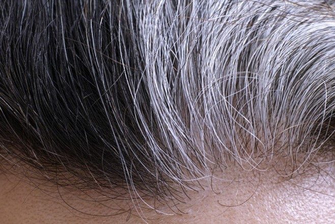 TÓC BẠC SỚM LÀ DẤU HIỆU SẼ YẾU SINH LÝ?
