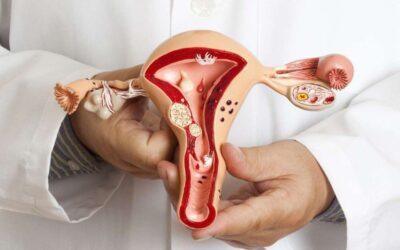 Nên chụp tử cung vòi trứng khi nào? Tìm hiểu ý kiến chuyên khoa