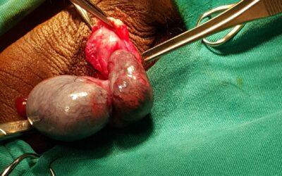 [:vi]Xoắn tinh hoàn[:]