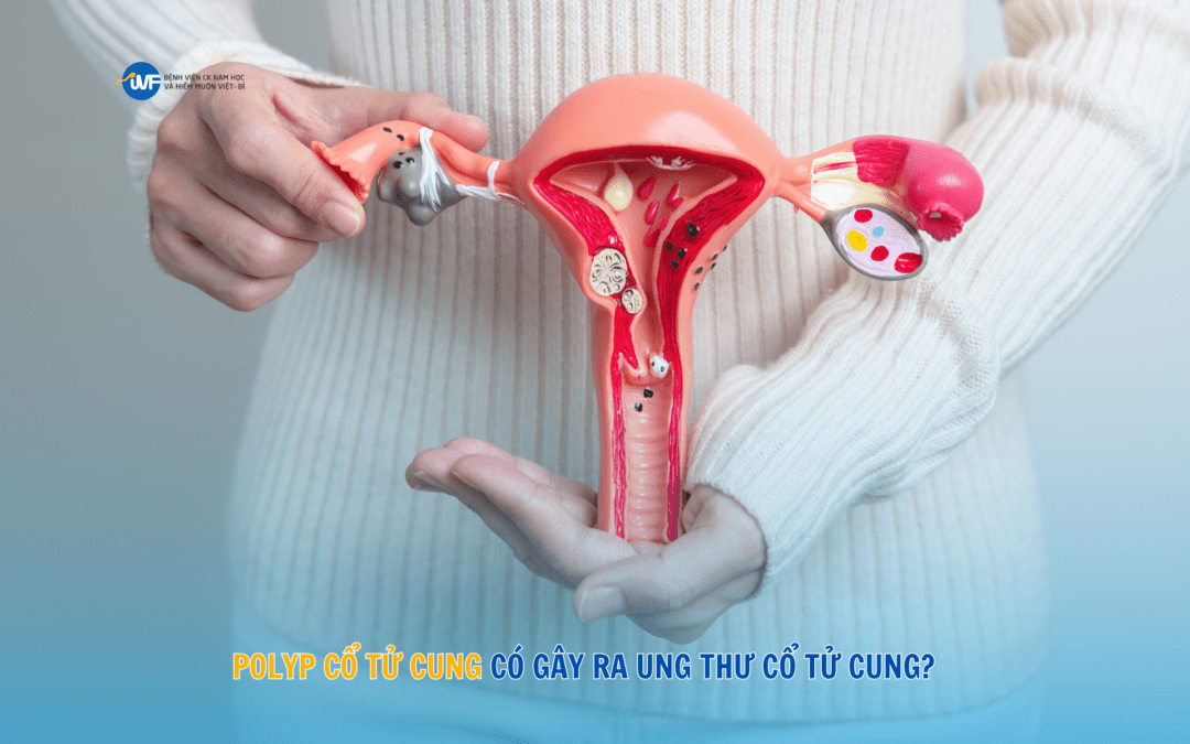 POLYP CỔ TỬ CUNG CÓ GÂY RA UNG THƯ CỔ TỬ CUNG?