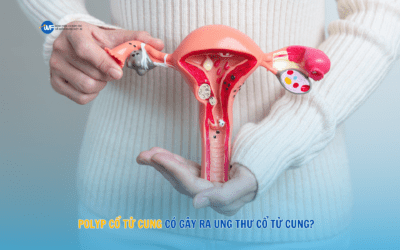 POLYP CỔ TỬ CUNG CÓ GÂY RA UNG THƯ CỔ TỬ CUNG?