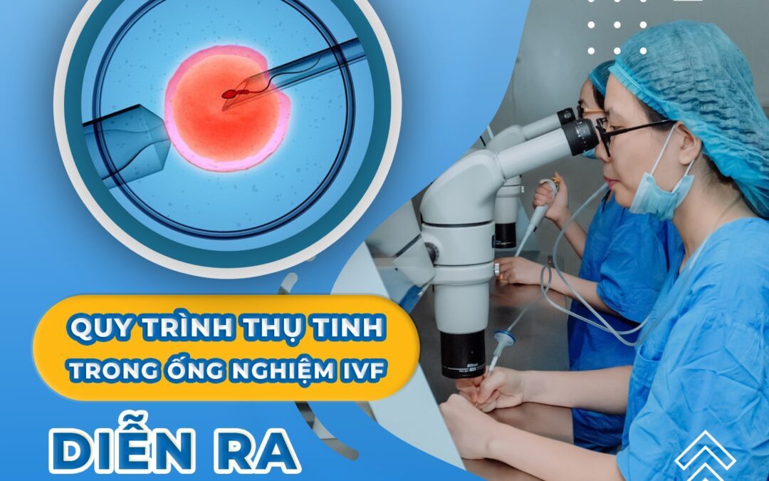 CÁC BƯỚC LÀM IVF  – HÀNH TRÌNH HIỆN THỰC HÓA GIẤC MƠ ĐÓN CON YÊU