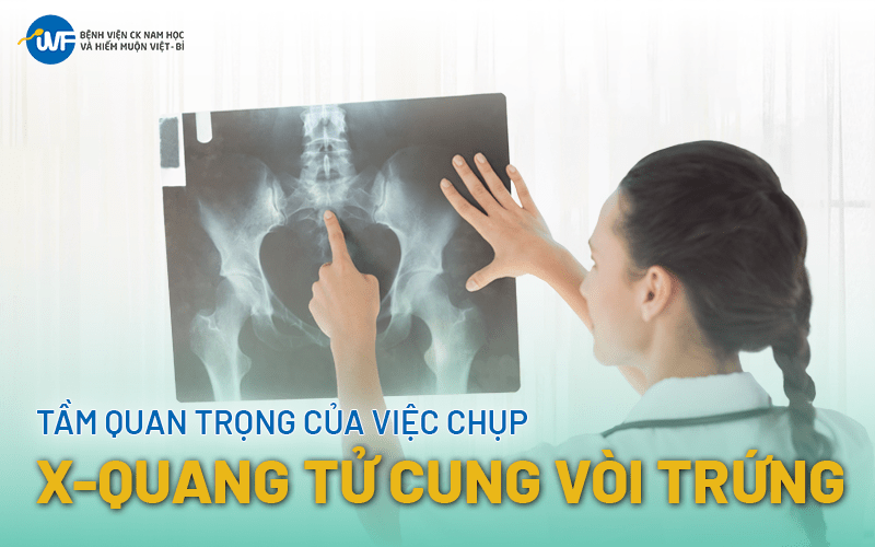 CHỤP X-QUANG TỬ CUNG VÒI TRỨNG CÓ QUAN TRỌNG KHÔNG?