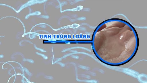 “TINH BINH LOÃNG” CÓ TỰ KHỎI KHÔNG?