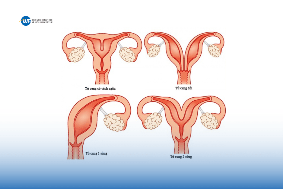 DỊ DẠNG TỬ CUNG ẢNH HƯỞNG RA SAO ĐẾN KHẢ NĂNG SINH SẢN CỦA PHỤ NỮ?