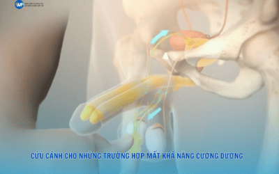 CỨU CÁNH CHO NHỮNG TRƯỜNG HỢP MẤT KHẢ NĂNG CƯƠNG DƯƠNG