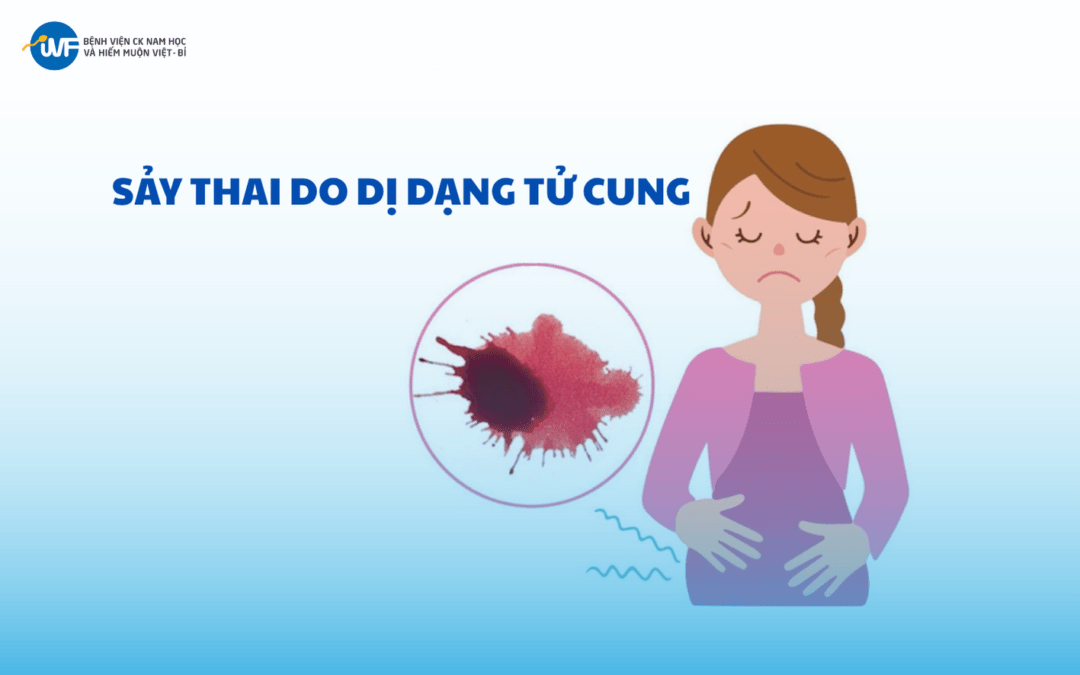 SẢY THAI DO DỊ DẠNG TỬ CUNG: NGUYÊN NHÂN, PHÂN LOẠI VÀ GIẢI PHÁP ĐIỀU TRỊ HIỆU QUẢ